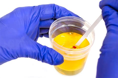 urine test hard|how to check for urine appearance.